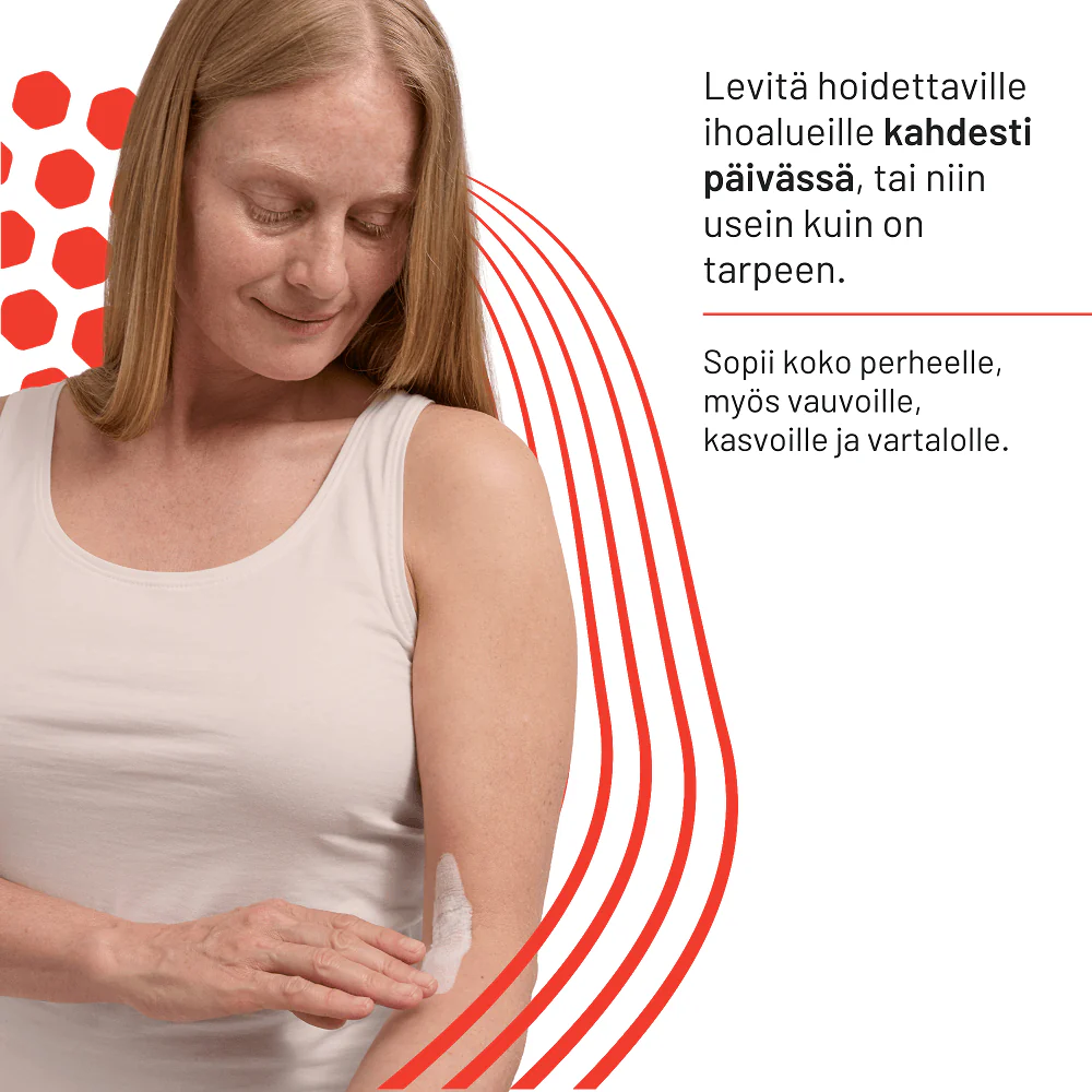 Locobase Eczema Cream - Atooppiselle iholle - Image 4